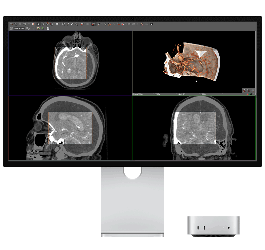 Studio Display XDR